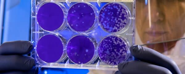 A lab worker examines 6 petri dishes for colonies of bacteria