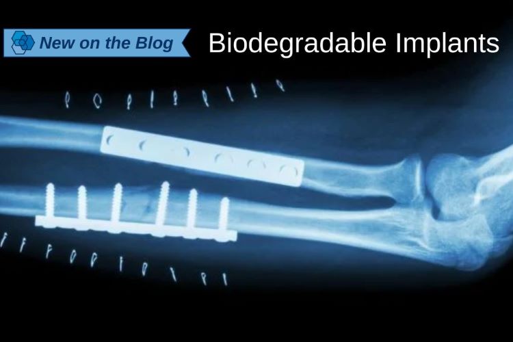 Biodegradable Implant
